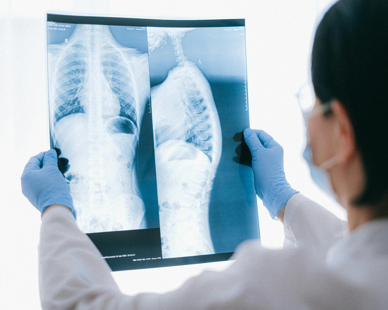 Remedios contra el cáncer al 100%